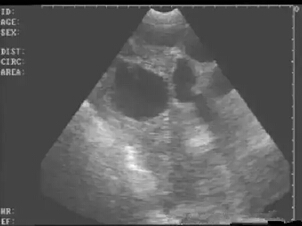 Detailed picture and text explanation of the usage of the B-ultrasound machine for pigs(图12)