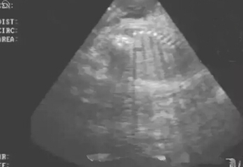 Detailed picture and text explanation of the usage of the B-ultrasound machine for pigs(图24)