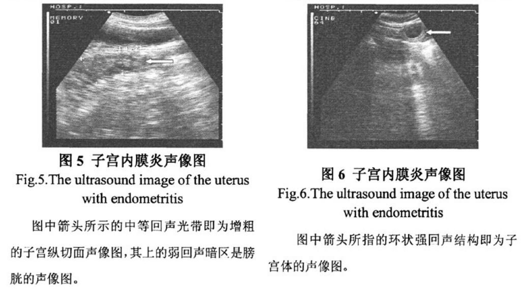 Characteristics of endometritis in dogs detected by veterinary B-ultrasound(图2)