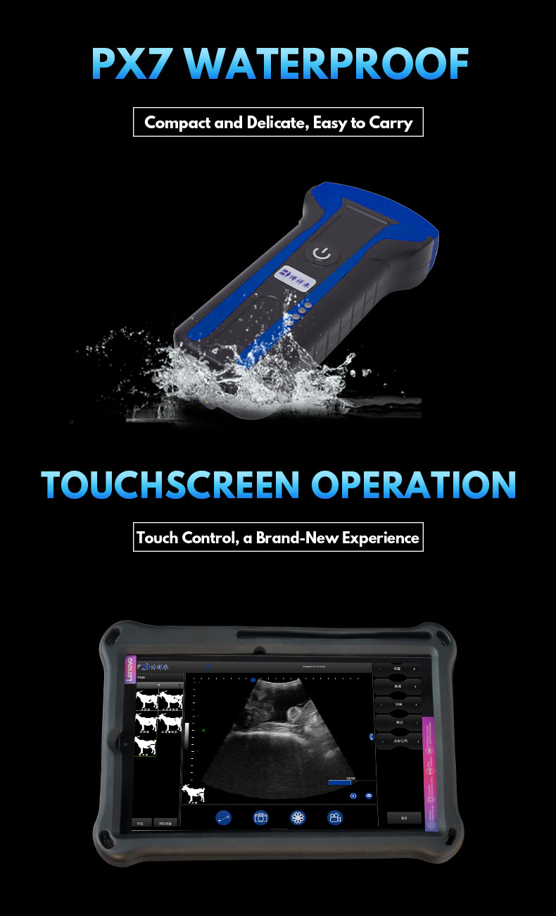 BXL-S101 Wireless veterinary ultrasound machine(图3)