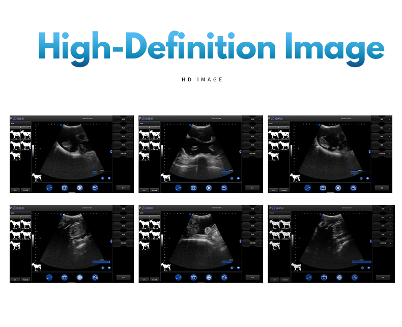BXL-S101 Wireless veterinary ultrasound machine(图6)