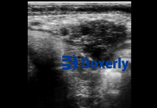 How Next-Gen Portable Pig Ultrasound Devices Are Transforming Animal Care(图4)