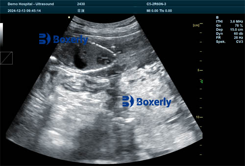 What is the difference between human ultrasound and animal ultrasound?(图5)