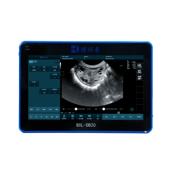 BXL-DB20 Vet OPU Doppler | For oocyte collection in cattle, horses, camels