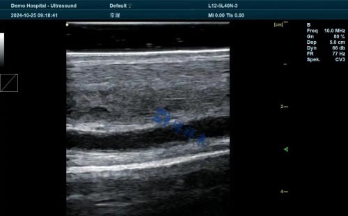 The application of veterinary ultrasound in the health management of racehorses(图3)