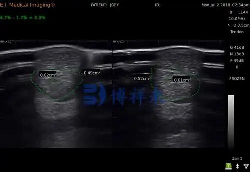 The application of veterinary ultrasound in the health management of racehorses(图2)