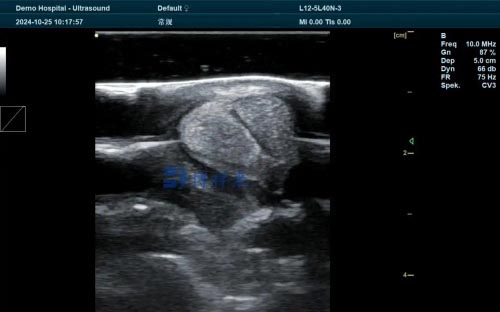 The application of veterinary ultrasound in the health management of racehorses(图4)