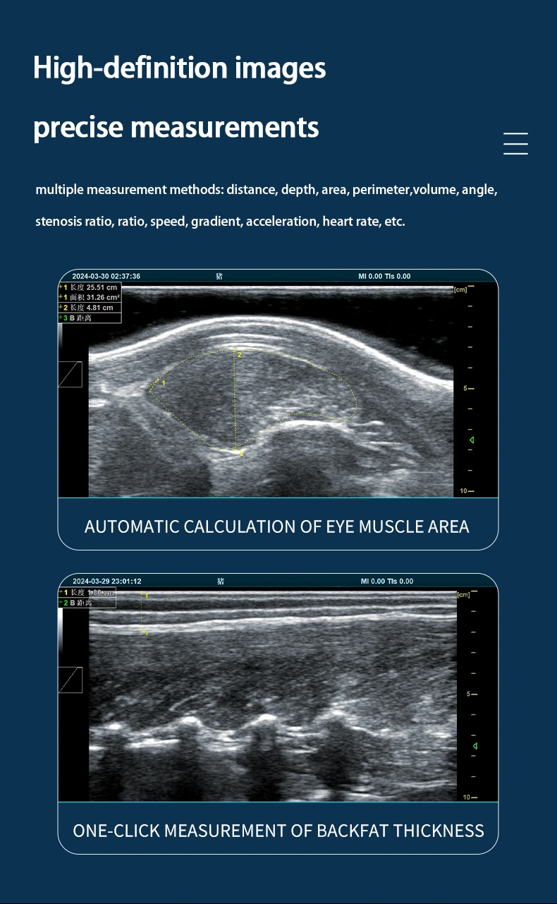 BXL-DB20 veterinary back fat eye muscle measuring instrument(图3)