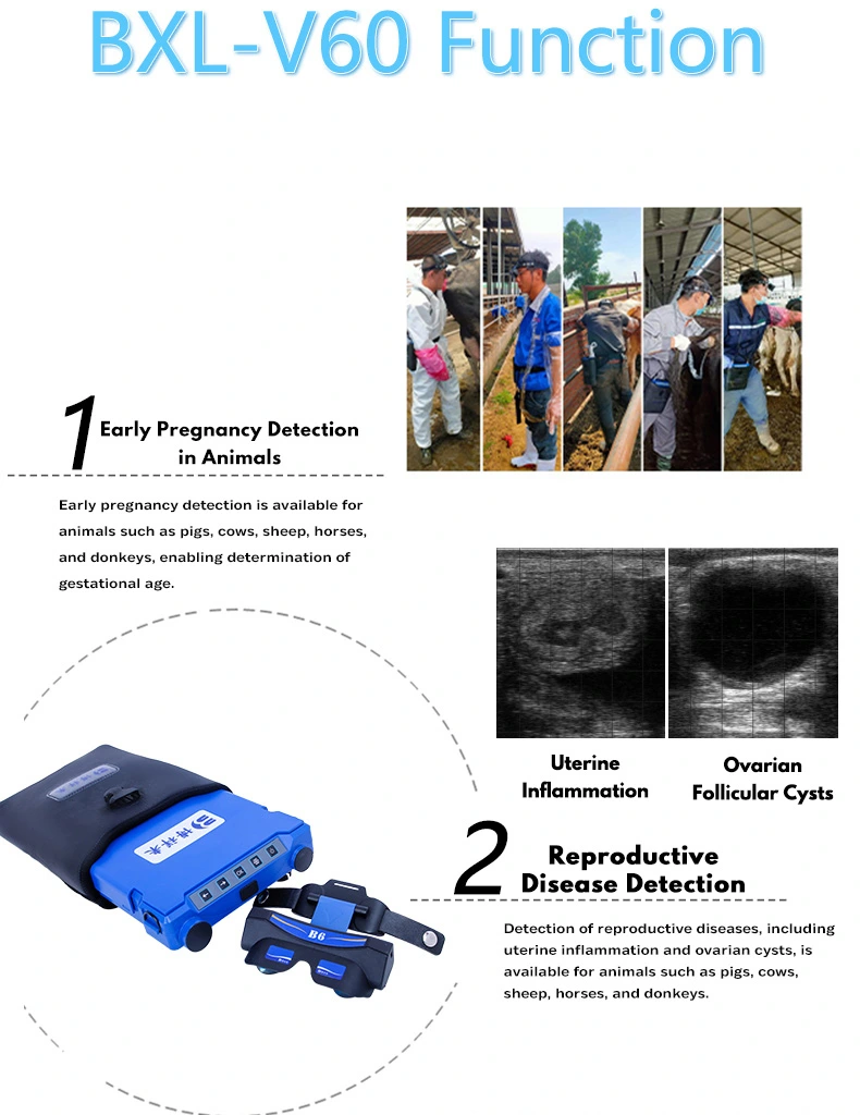 BXL-V60 Portable Video Glasses Ultrasound Instrument(图6)