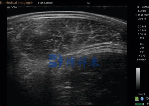 veterinary ultrasound equipment for sale | AU Portable Ultrasound Equipment(图5)