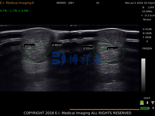 Equine tendon ultrasound: a guide to accurate imaging and diagnosis(图2)