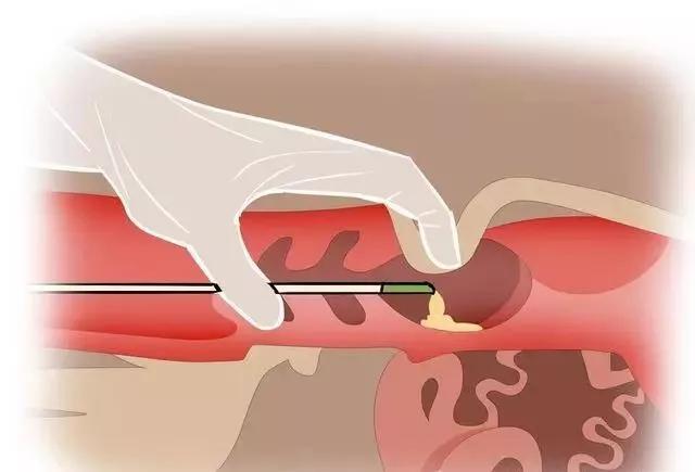 The role of veterinary B-ultrasound machine in the breeding management of cows