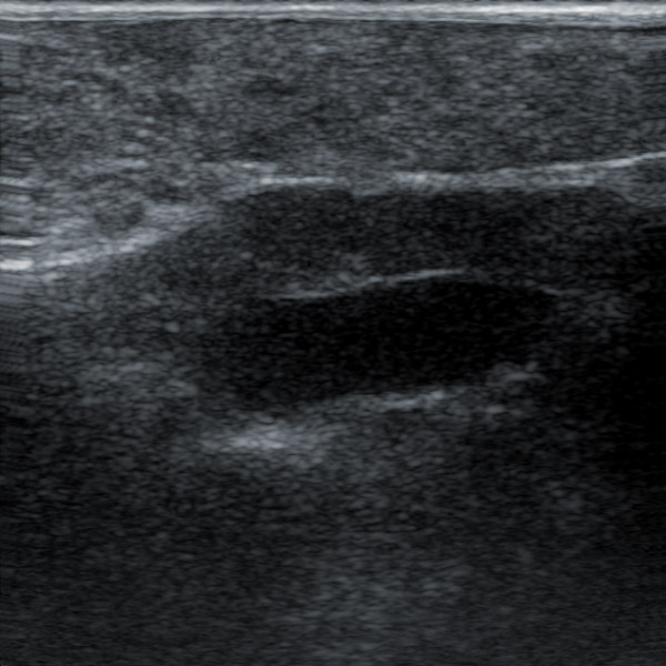 Veterinary Ultrasound in Monitoring Abnormal Uterine Fluid and Fetal Health in Pregnant Dogs(图2)