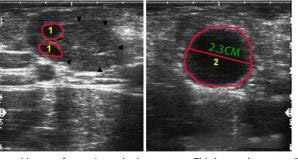 Ultrasound Insights into Pre-Estrus Ovarian Activity in Cows(图2)