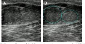 Ultrasound Insights into Pre-Estrus Ovarian Activity in Cows(图3)