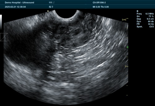 Veterinary Ultrasound Texture Analysis in Modern Livestock Diagnosis