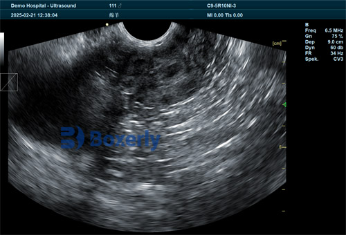Accuracy of Ultrasound Pregnancy Tools in Detecting Early Pregnancy in Alpacas(图2)