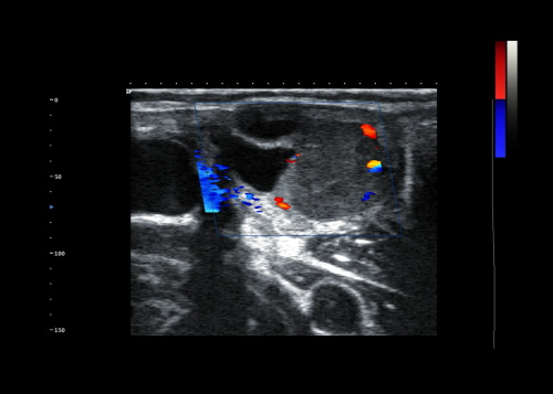 What is the Difference Between Doppler and B Mode Ultrasound?(图1)