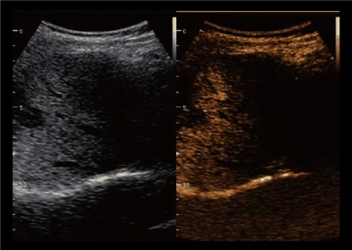 Ultrasound Artifacts Application: What Every Vet Should Know About Seeing Beyond the Image(图1)