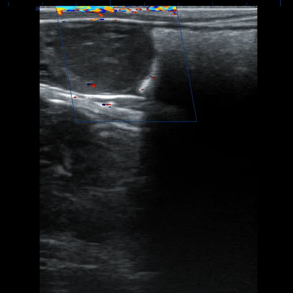 Rectal probe measuring cow corpus luteum