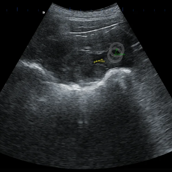 Large convex probe measuring pig follicle diameter