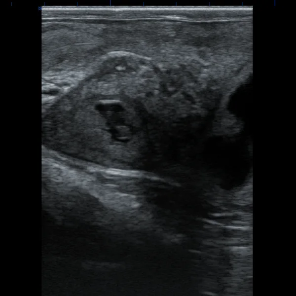 Rectal probe examining the uterus of a cow