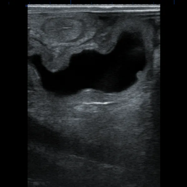 Rectal probe examination of the corpus luteum in cattle