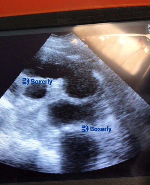 How to Determine Fetal Health Through B-Mode Ultrasound Images in Swine(图3)